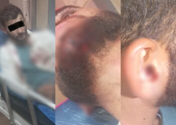 Denoncimi/ Policia greke dhunon të riun shqiptar, ndodhet në gjendje të rëndë në spital