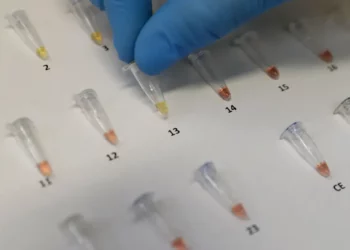 OBSH: Tuberkulozi, sëmundja më vdekjeprurëre në botë! Shifër rekord infektimesh