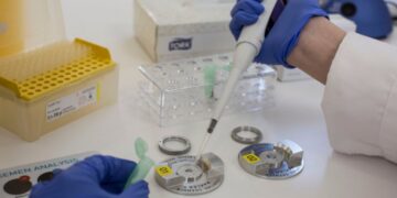 Zbulimi shokues/ Në Europë u përdor spermë nga dhurues me kancer, e përfshirë edhe Shqipëria