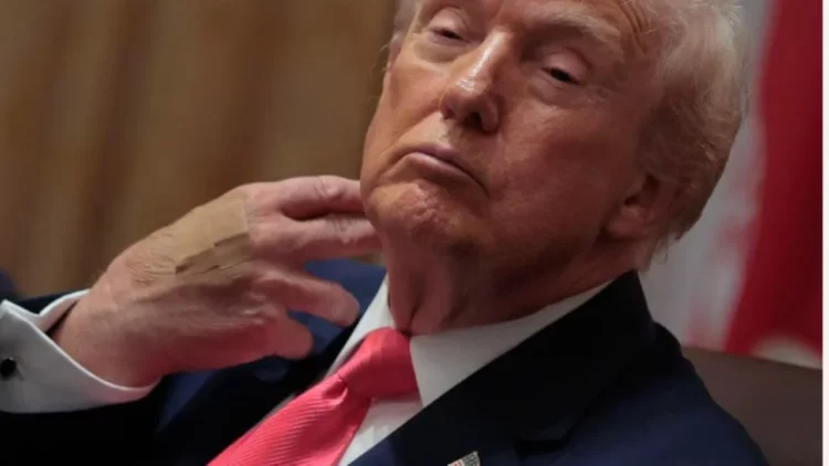 Trump me fasha në duar, reagon Shtëpia e Bardhë: Nuk është i sëmurë