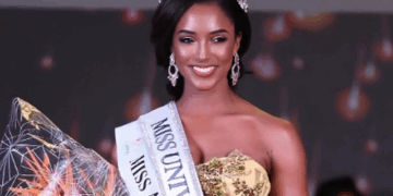 Aksidenti i rëndë i Miss Xhamajka, u rrëzua gjatë provave dhe pësoi…