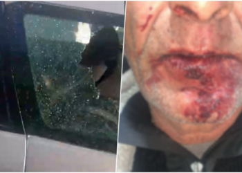 Dhuna barbare ndaj çiftit në Durrës, ngujohet familja: Kemi frikë të dalim se autorët lëvizin të lirë