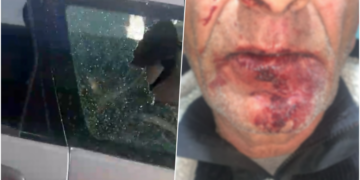 Dhuna barbare ndaj çiftit në Durrës, ngujohet familja: Kemi frikë të dalim se autorët lëvizin të lirë