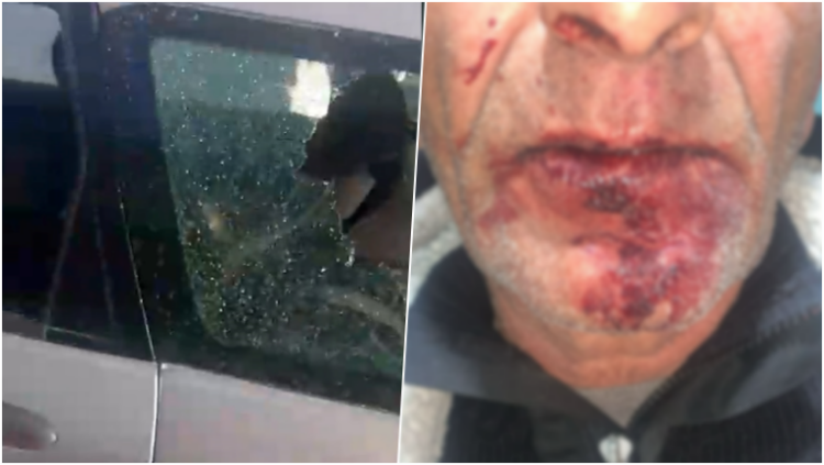 Dhuna barbare ndaj çiftit në Durrës, ngujohet familja: Kemi frikë të dalim se autorët lëvizin të lirë