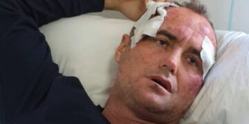 E kam denoncuar për përndjekje, reagon motra e Fredi Lamajt: Altin Mecaj po shpif, vëllai im nuk ka dhunuar askënd