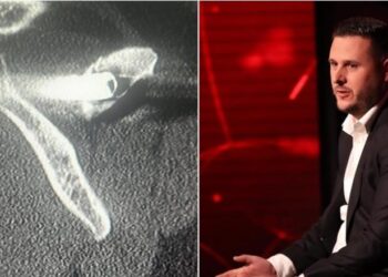 “Kam 27 vite me plumb në trup”- I mbijetuari i masakrës së Suharekës rrëfen tmerrin nga serbët