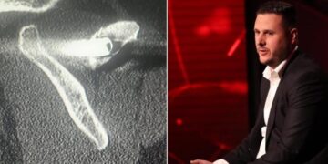 “Kam 27 vite me plumb në trup”- I mbijetuari i masakrës së Suharekës rrëfen tmerrin nga serbët