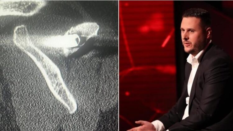 “Kam 27 vite me plumb në trup”- I mbijetuari i masakrës së Suharekës rrëfen tmerrin nga serbët