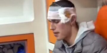 Me plagë në kokë, policia e dhunon protestuesin në komisariat dhe refuzon ta dërgojë në spital