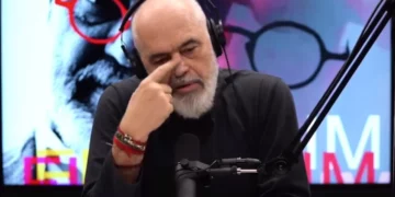 Rama do të bëjë hundë të re? Kryeministri fon në podcast një kirurge dhe i tregon dëmtimin nga dhuna e vitit ’97