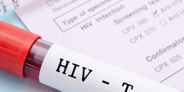 Raporti i HIV 2025: Shqipëria përballë një vale të re infeksionesh, rekord që nga 2016-a