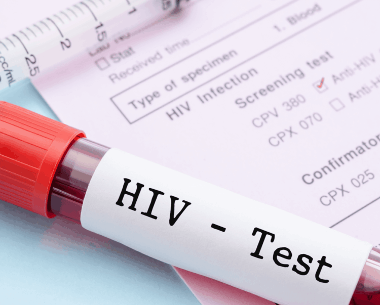 Raporti i HIV 2025: Shqipëria përballë një vale të re infeksionesh, rekord që nga 2016-a