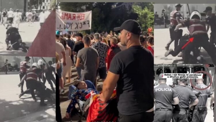 U arrestua dje nga policia se protestoi, shqiptarët dhurojnë mbi 115 mijë € për babain e djalit të paralizuar