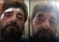 Dhunohet Ilir Demalia, analisti kallëzon në polici: Më sulmuan dy persona