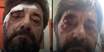Dhunohet Ilir Demalia, analisti kallëzon në polici: Më sulmuan dy persona