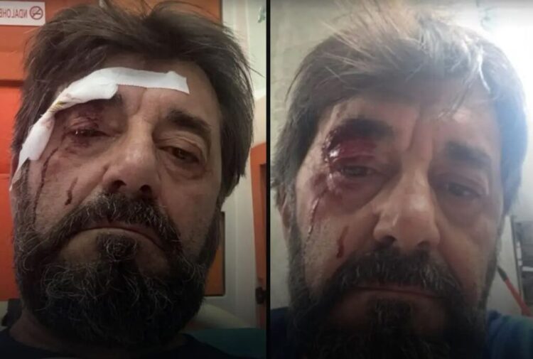 Dhunohet Ilir Demalia, analisti kallëzon në polici: Më sulmuan pranë banesës