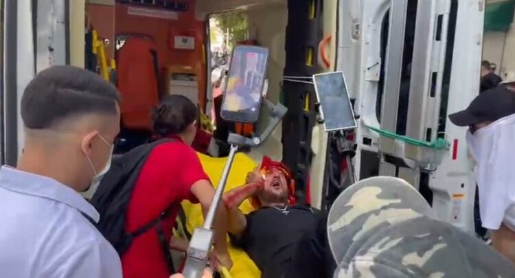 Protestuesi mbulohet me gjak nga plagët në kokë, transportohet me urgjencë drejt ambulancës