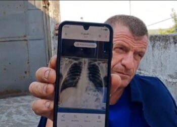 Me brinjë të dëmtuara e ilaçe në xhep, zjarrfikësi s’e braktis detyrën/ 5 ditë pa gjumë, komandanti: Do të rrimë derisa të shuhet vatra e fundit