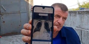 Me brinjë të dëmtuara e ilaçe në xhep, zjarrfikësi s’e braktis detyrën/ 5 ditë pa gjumë, komandanti: Do të rrimë derisa të shuhet vatra e fundit