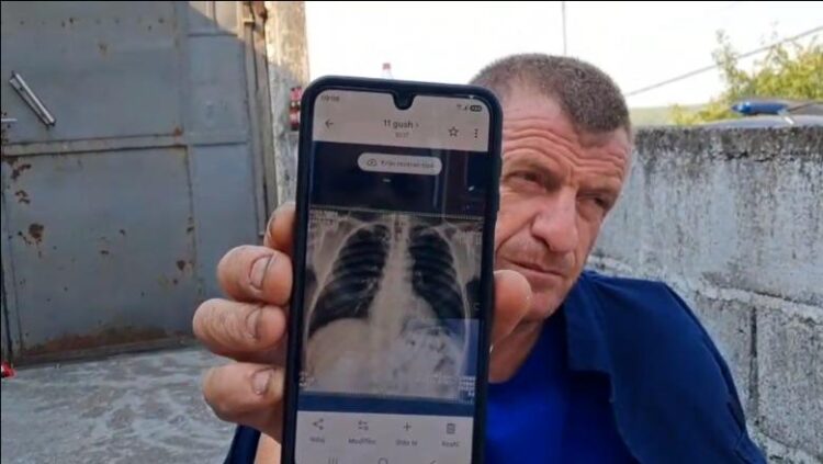 Me brinjë të dëmtuara e ilaçe në xhep, zjarrfikësi s’e braktis detyrën/ 5 ditë pa gjumë, komandanti: Do të rrimë derisa të shuhet vatra e fundit
