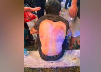Dhunohen 6 turistë italianë në Tiranë, rrëfimi tronditës