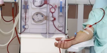 Pas PPP-së, shteti tenderon dializën me kosto 43 % më të lartë se mesatarja e koncesionit