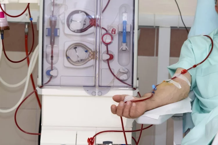 Pas PPP-së, shteti tenderon dializën me kosto 43 % më të lartë se mesatarja e koncesionit