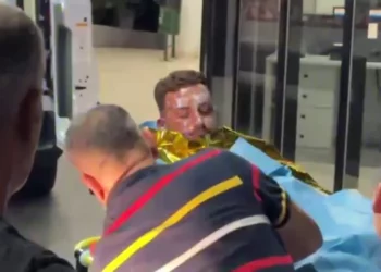 Shpërthen motori i skafit në Porto Palermo, 4 të plagosur. Dy prej tyre me djegie të rënda në trup