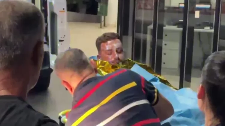 Shpërthen motori i skafit në Porto Palermo, 4 të plagosur. Dy prej tyre me djegie të rënda në trup