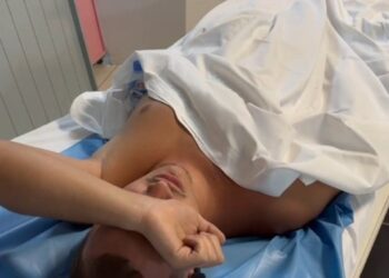 Zjarri në hotelin në Vlorë, pushuesi nga Kosova: U hodhëm nga ballkoni për t’i shpëtuar flakëve