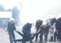 U rrah nga policët dhe i thyen këmbën/ Studenti te “Trauma”, ja si është gjendja e të riut
