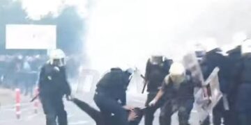 U rrah nga policët dhe i thyen këmbën/ Studenti te “Trauma”, ja si është gjendja e të riut