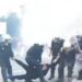 U rrah nga policët dhe i thyen këmbën/ Studenti te “Trauma”, ja si është gjendja e të riut