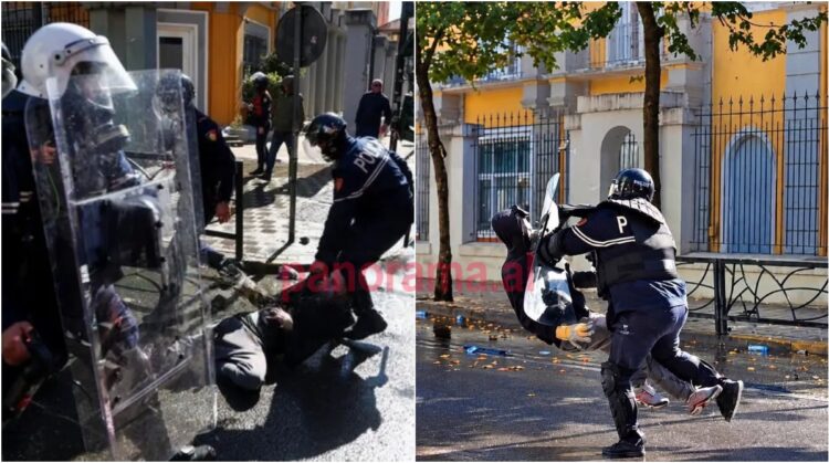 Studenti u dhunua nga policët, gazetarja: Ka krisje në vertebër dhe humbje të kujtesës!
