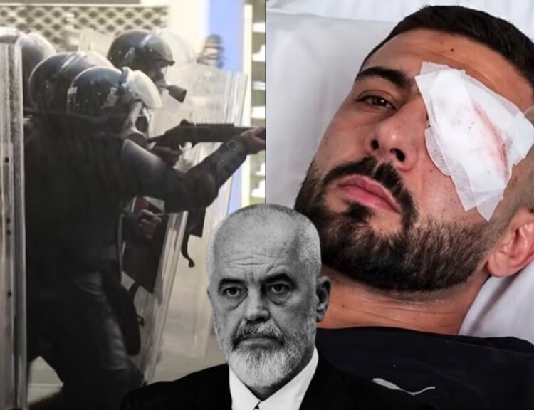 Demokratët Evropianë: Kërkojmë hetim të pavarur, Erjon Vishkulli meriton drejtësi, jo propogandë