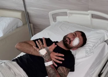 Policia e qëlloi me plumb gome në sy/ Reagon Erjon Vishkulli: Faleminderit për mbështetjen , u shtofshin shqiptarët e mirë!