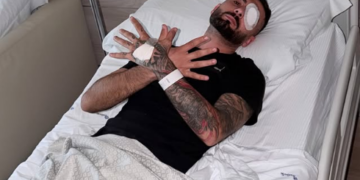 U lëndua në sy gjatë protestës/ Erjon Vishkulli publikon mesazhin nga Italia: Zoti do të krijojë lehtësim pas vështirësive
