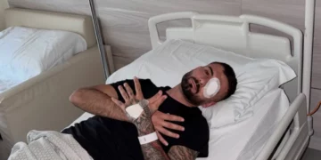 Policia e qëlloi me plumb gome në sy/ Reagon Erjon Vishkulli: Faleminderit për mbështetjen , u shtofshin shqiptarët e mirë!
