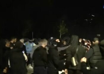 U godit në kokë nga Policia, e reja te Trauma, ja si është gjendja e saj