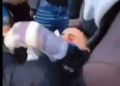 Pamje të rënda nga protesta, i riu me gjakderdhje në sy pas goditjes me plumb gome