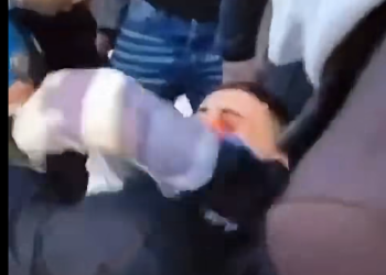 Pamje të rënda nga protesta, i riu me gjakderdhje në sy pas goditjes me plumb gome