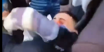 Pamje të rënda nga protesta, i riu me gjakderdhje në sy pas goditjes me plumb gome