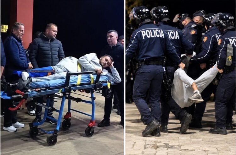 E dhunuan edhe pasi ia thyen këmbën, 19-vjeçari i nënshtrohet ndërhyrjes kirurgjikale