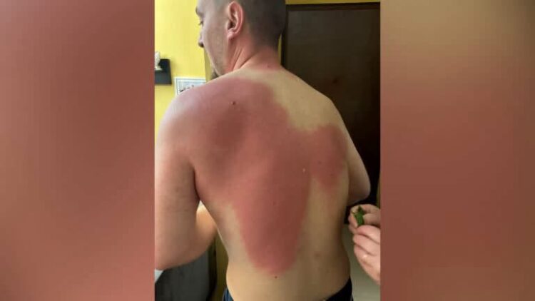 Gazetari Klevin Muka u lëndua nga uji me solucion, Berisha dënon sulmin: Akt kriminal dhe hakmarrje primitive