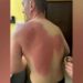 Gazetari Klevin Muka u lëndua nga uji me solucion, Berisha dënon sulmin: Akt kriminal dhe hakmarrje primitive