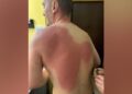 Lëndimi i gazetarit Klevin Muka, reagon SafeJournalists: Kërkojmë hetim të pavarur dhe llogaridhënie për veprimet e Policisë