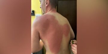 Lëndimi i gazetarit Klevin Muka, reagon SafeJournalists: Kërkojmë hetim të pavarur dhe llogaridhënie për veprimet e Policisë