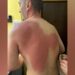 Lëndimi i gazetarit Klevin Muka, reagon SafeJournalists: Kërkojmë hetim të pavarur dhe llogaridhënie për veprimet e Policisë