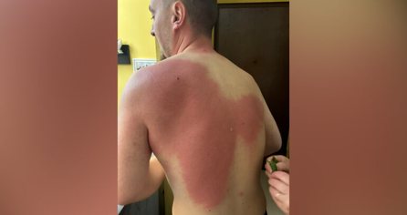 Lëndimi i gazetarit Klevin Muka, reagon SafeJournalists: Kërkojmë hetim të pavarur dhe llogaridhënie për veprimet e Policisë