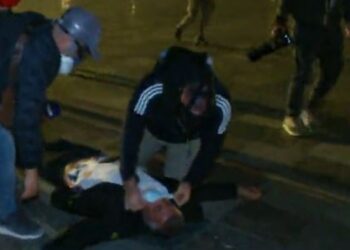 Agravimi i situatës, një person përfundon pa ndjenja te “Sheshi Skënderbej”